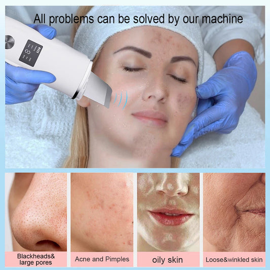 Ultrasonic Facial Scrubber Peeling Tool
