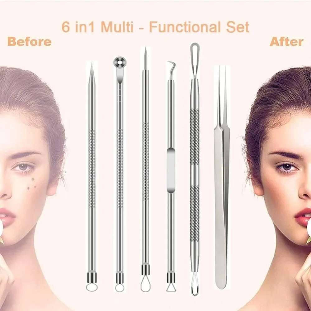 blackhead remover tools, stainless steel blackhead remover, 6pcs blackhead remover kit, blackhead extractor set, stainless steel pimple remover, acne removal tools, facial care tools, blackhead removal kit, stainless steel blemish extractor, comedone extractor set, skincare tools, face cleaning kit, stainless steel facial tools, acne treatment tools, blackhead remover set