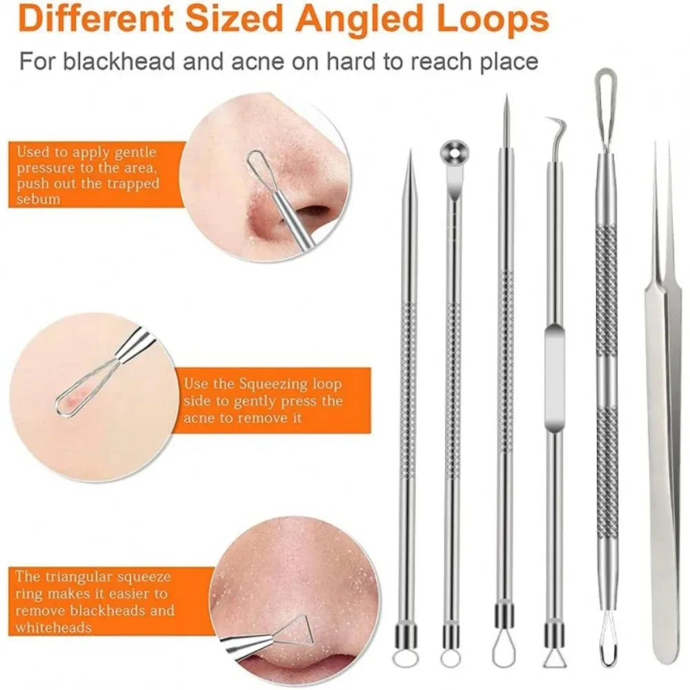 blackhead remover tools, stainless steel blackhead remover, 6pcs blackhead remover kit, blackhead extractor set, stainless steel pimple remover, acne removal tools, facial care tools, blackhead removal kit, stainless steel blemish extractor, comedone extractor set, skincare tools, face cleaning kit, stainless steel facial tools, acne treatment tools, blackhead remover set
