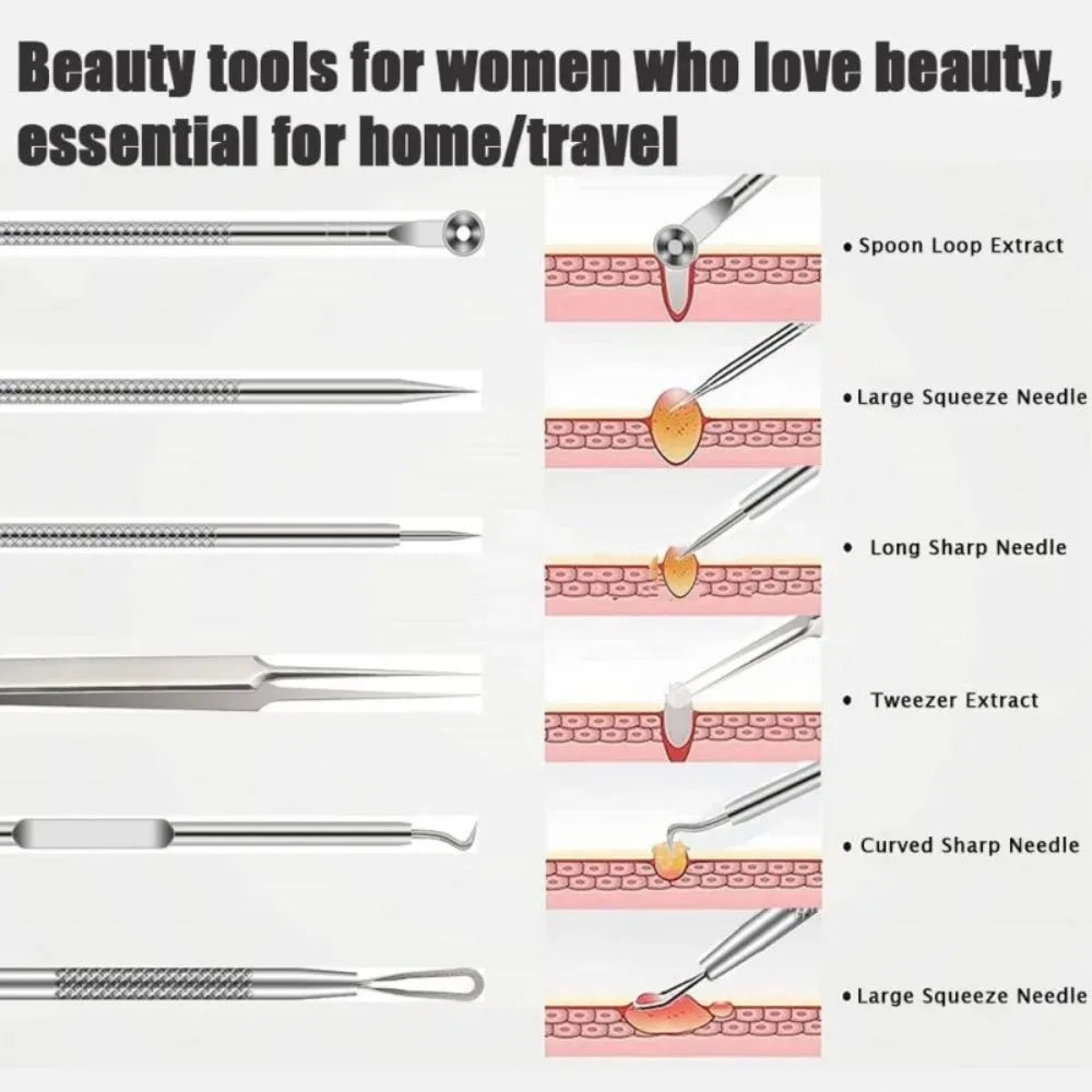 blackhead remover tools, stainless steel blackhead remover, 6pcs blackhead remover kit, blackhead extractor set, stainless steel pimple remover, acne removal tools, facial care tools, blackhead removal kit, stainless steel blemish extractor, comedone extractor set, skincare tools, face cleaning kit, stainless steel facial tools, acne treatment tools, blackhead remover set