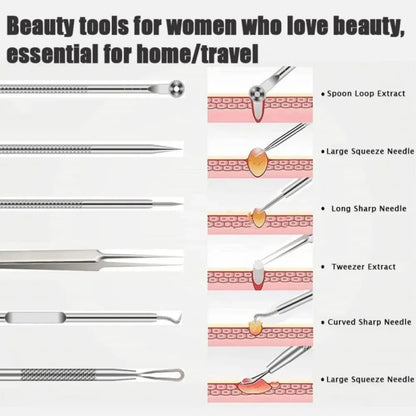 blackhead remover tools, stainless steel blackhead remover, 6pcs blackhead remover kit, blackhead extractor set, stainless steel pimple remover, acne removal tools, facial care tools, blackhead removal kit, stainless steel blemish extractor, comedone extractor set, skincare tools, face cleaning kit, stainless steel facial tools, acne treatment tools, blackhead remover set