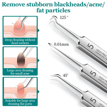 Blackhead Removal Kit - Deep Cleansing Acne Tools