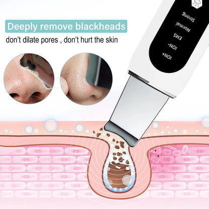 Deep Cleaning Ultrasonic Blackhead Remover and Facial Cleanser