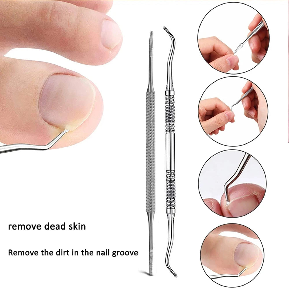 Kit de correction des ongles incarnés - Outils de traitement