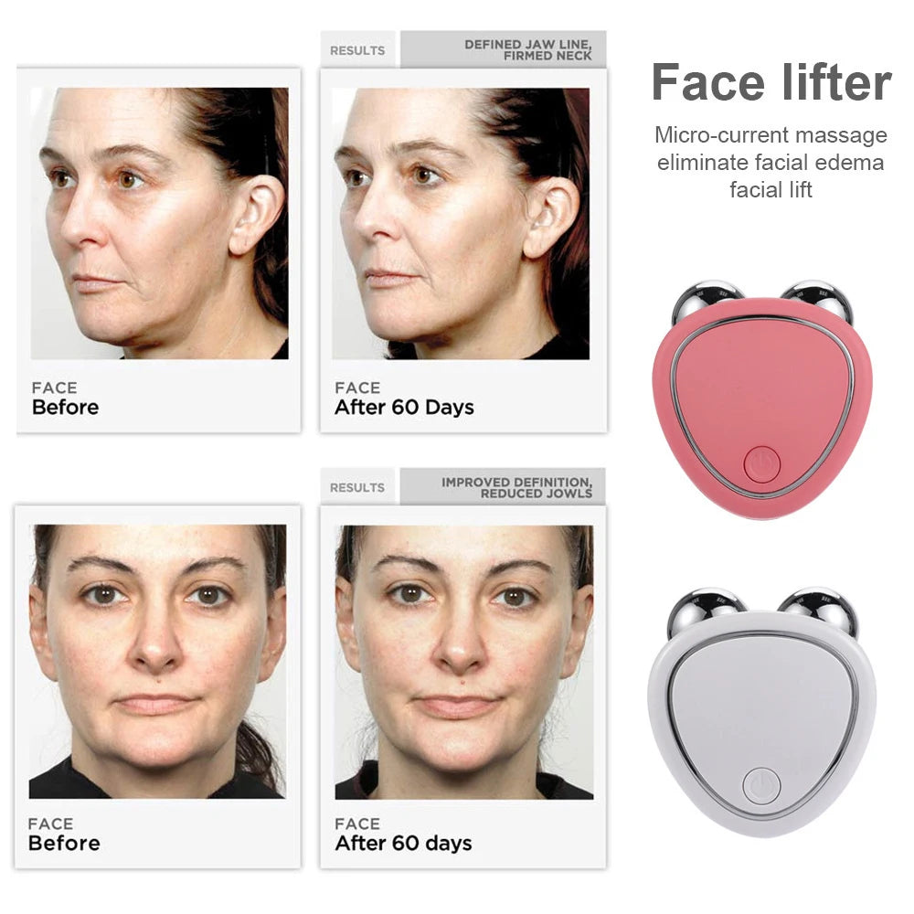 Microcurrent Roller - Facial Rejuvenation for Anti-Wrinkle Beauty